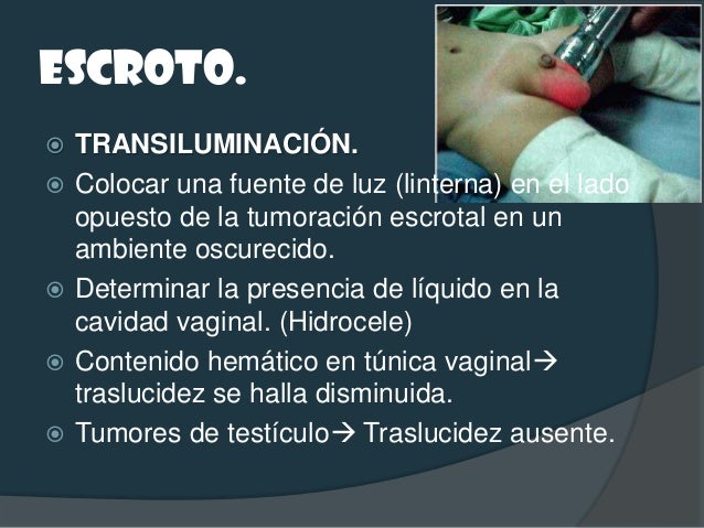 EPIDÍDIMO Y TESTÍCULO.   PALPACIÓN: 