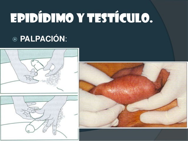 Del plástico del bridón del miembro viril en el precio