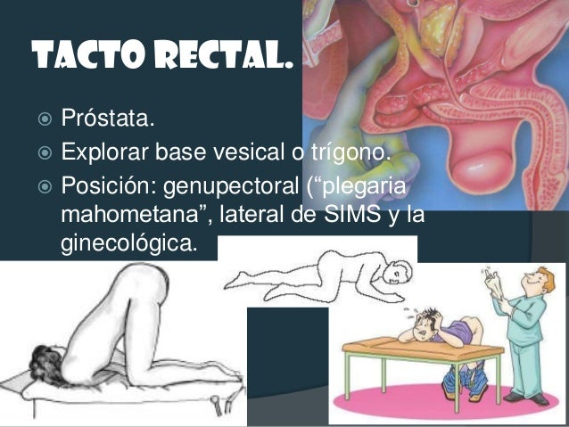 GLÁNDULAS DE COWPER.   Se exploran por tacto rectal mediante    pinzamiento perineal bidigital. 