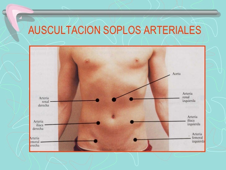 AUSCULTACION SOPLOS ARTERIALES 