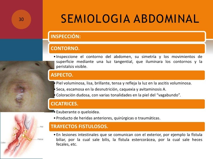 Semiologia abdominal.