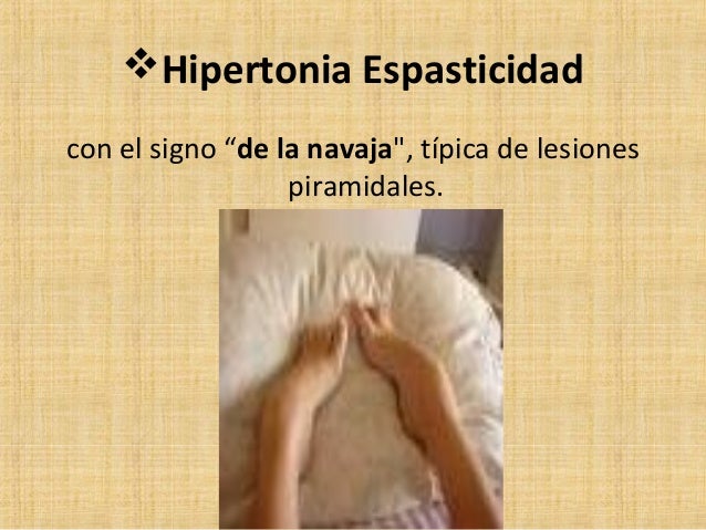 Semiologia del Sistema Nervioso
