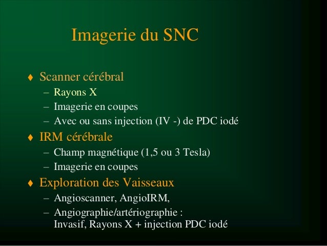 Tumeur Cerveau Astrocytome