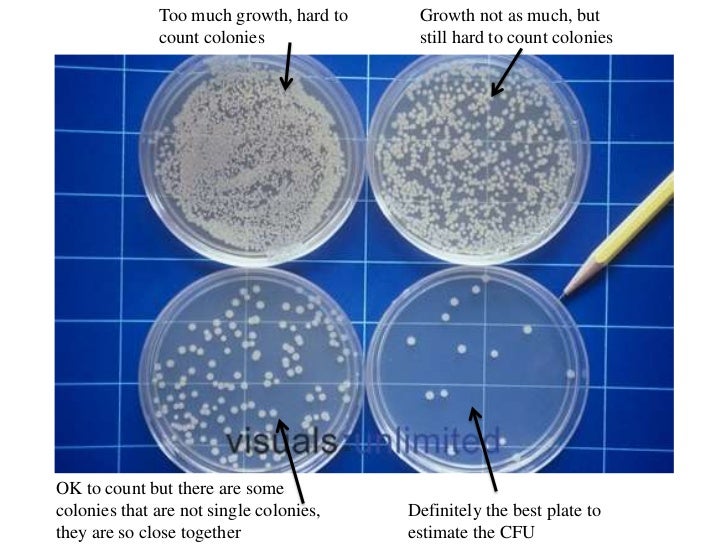 What Are Some Advantages And Disadvantages Of The Serial Dilution Agar Plate Te nalasopa