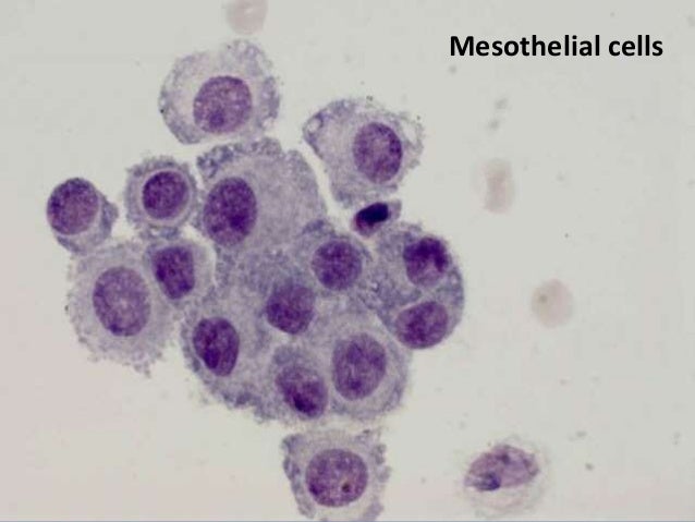asbestos lung mesothelioma symptoms