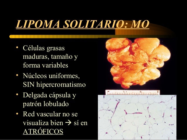 Si cuando la osteocondrosis puede estar enferma el corazón