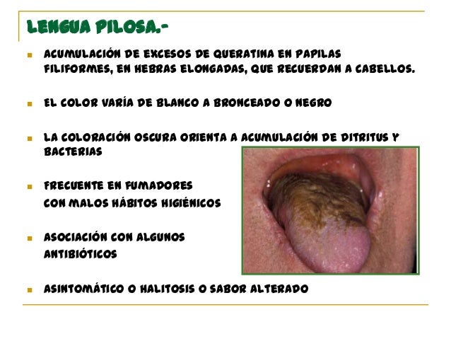 El ungüento de la psoriasis en la piel de los pies