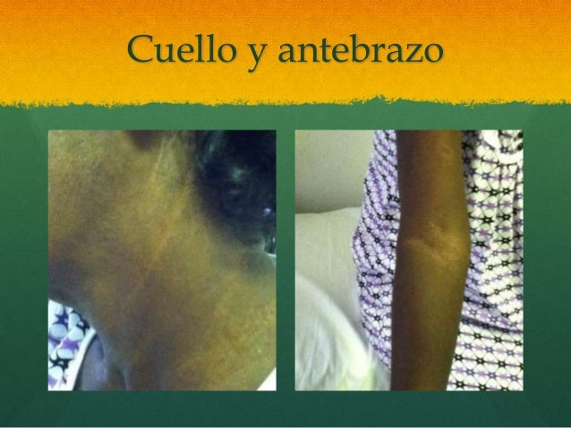 diclofenac and breastfeeding diclofenac and breastfeeding