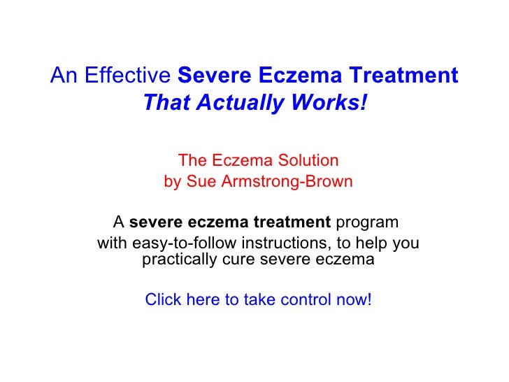 Severe Eczema Treatment