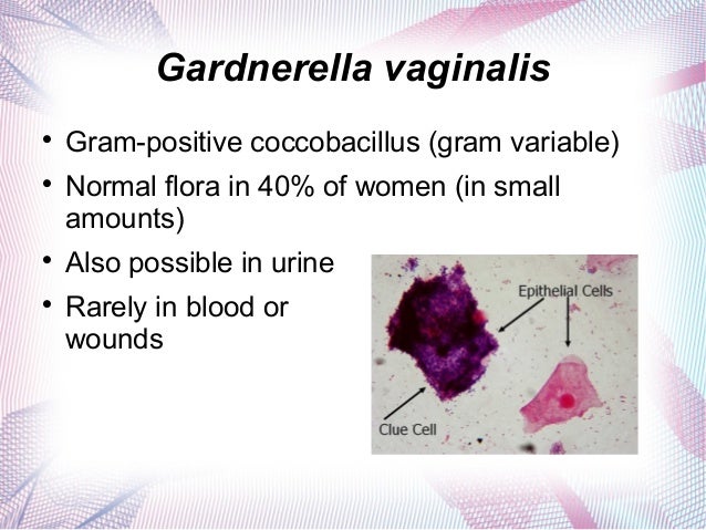 gardenella-vaginaliz-chto-eto gardenella-vaginaliz-chto-eto