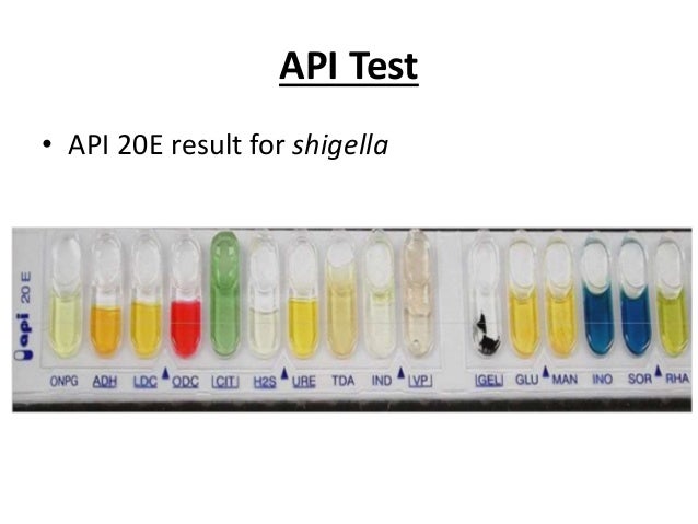 Shigella shigella
