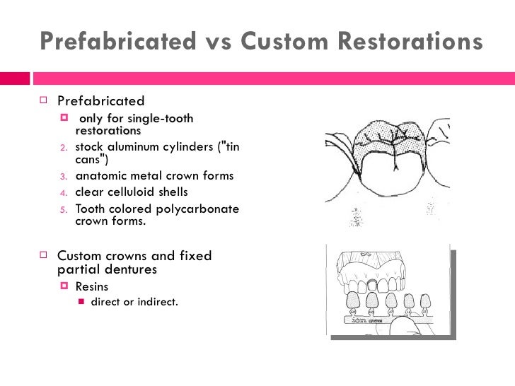 Shlinberg Temporary Crown And Bridge 87 8 21