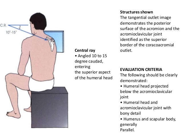 Shoulder girdle presentation