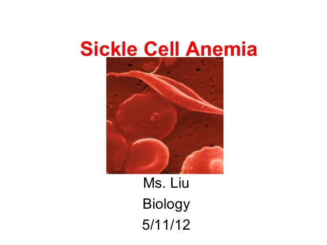 thesis on sickle cell anemia thesis on sickle cell anemia