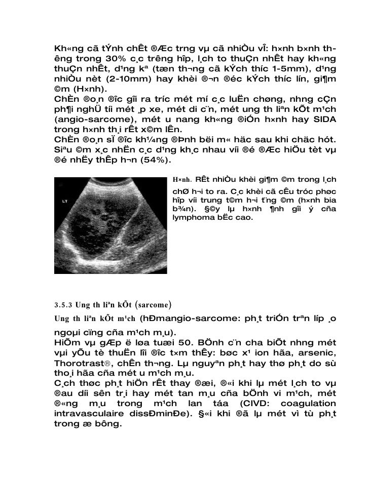 Lymphome Nh