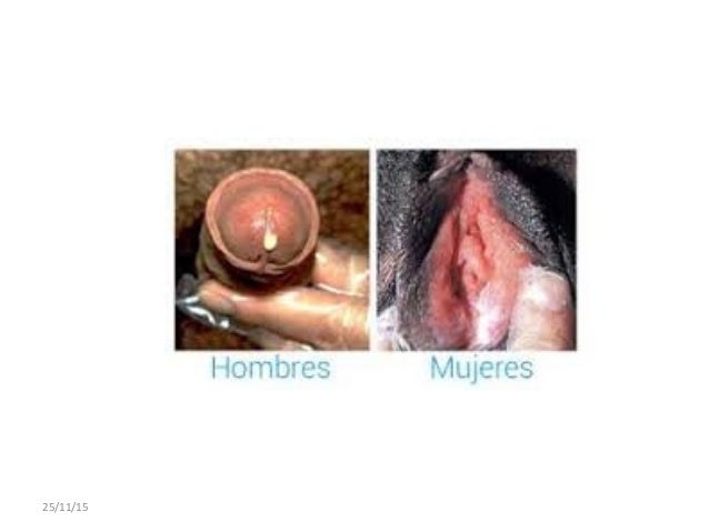 Como aumentar el miembro viril a la excitación