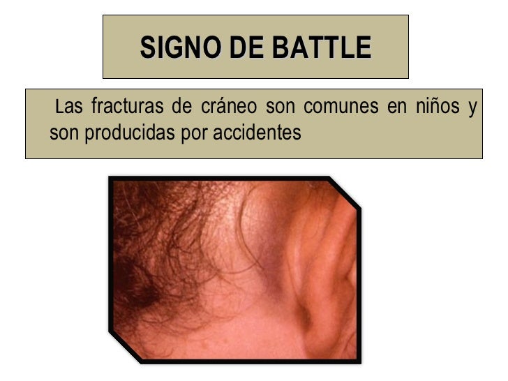 Signos Semiologicos...
