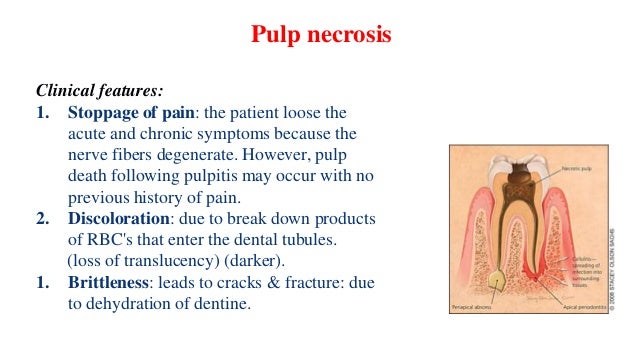 causes symptoms of treatment of bulimia causes symptoms of treatment of bulimia