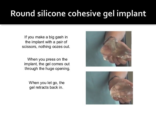 Cohesive Silicone Gel Implant 24