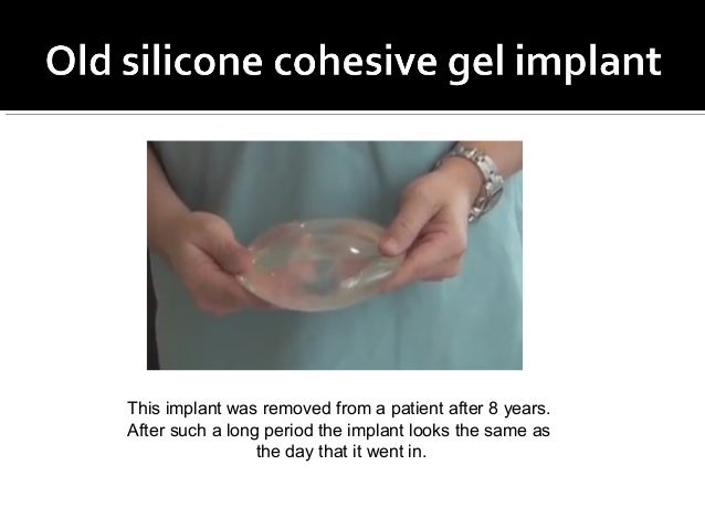 Cohesive Silicone Gel Implant 88