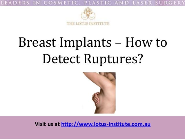 Ruptured Silicone Breast Implant 53