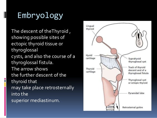 thyroid slide
