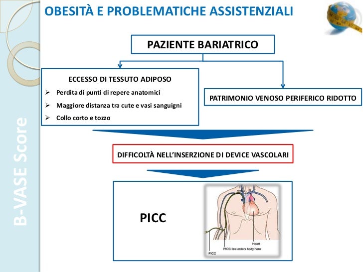 Il varicosity per trattare Perm