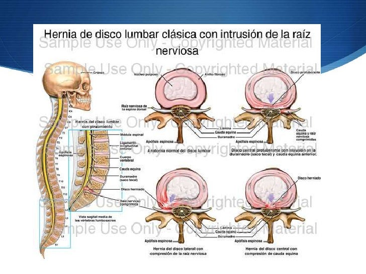 Que hacer si duele el cuello no puedo volver