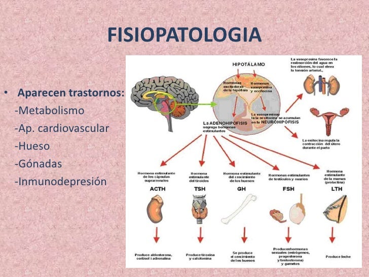 Sindrome de cushing