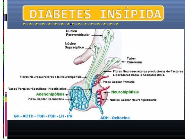 se clasifica la diabetes insípida según las causas en diabetes