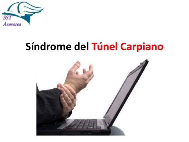 Sindrome del tunel carpiano Sindrome del tunel carpiano