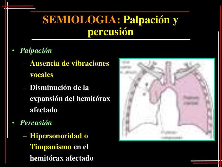 Síndromes clínicos respiratoriosSíndromes pleuropulmonares