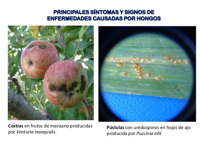 Resultado de imagen para enfermedades causadas por hongos en las plantas