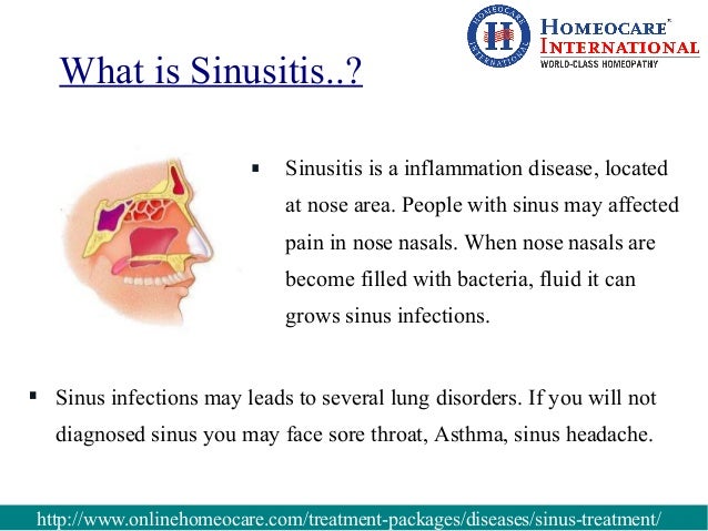 sinus decongestant being pregnant sinusitis mri analysis