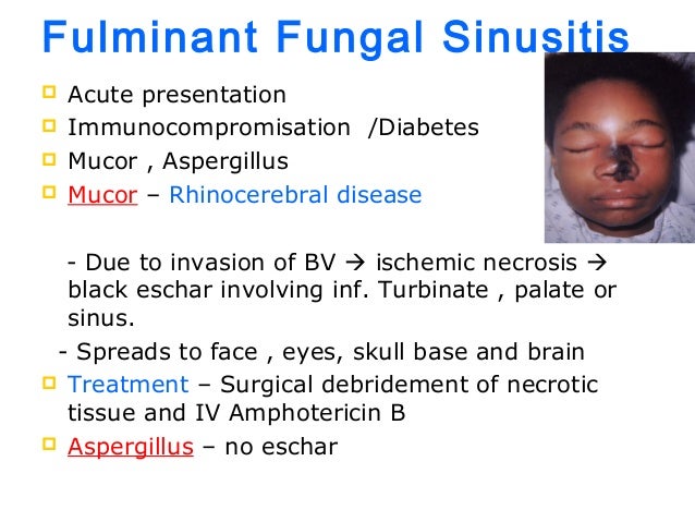 signs and symptoms and signs of allergic sinusitis