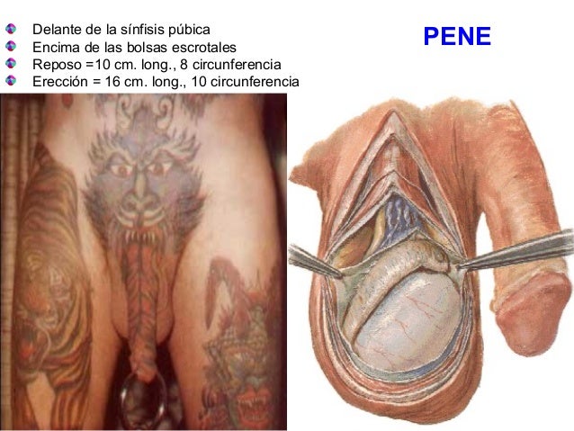 Como es posible aumentar el miembro