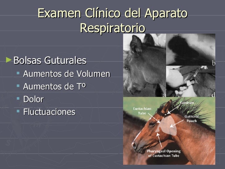 Sistema Respiratorio