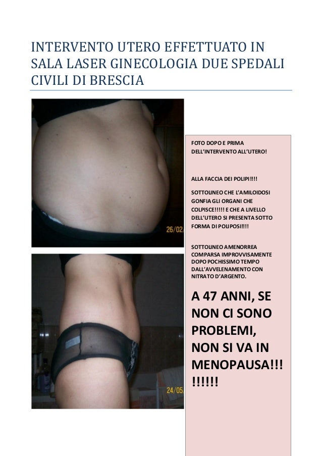 Se lolio shi questo martella un tempo su una faccia