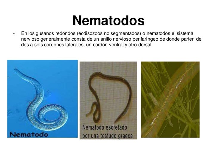 Los Nervios - La Lombriz Los Nervios - La Lombriz