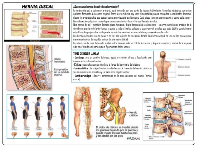Los dolores sobre la espalda por las dos partes de la columna vertebral