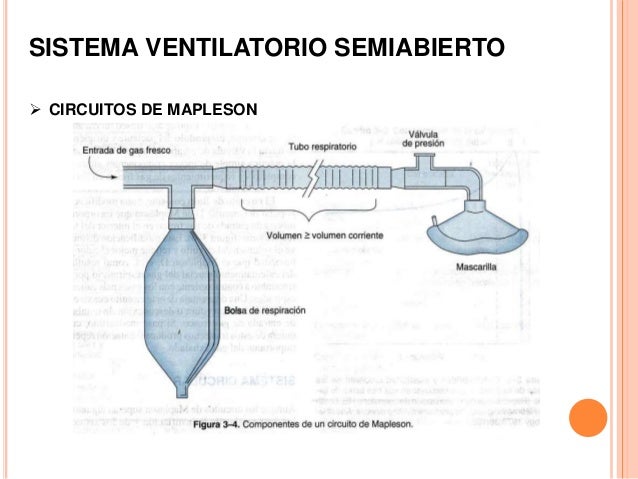 Sistemas y circuitos anestésicos