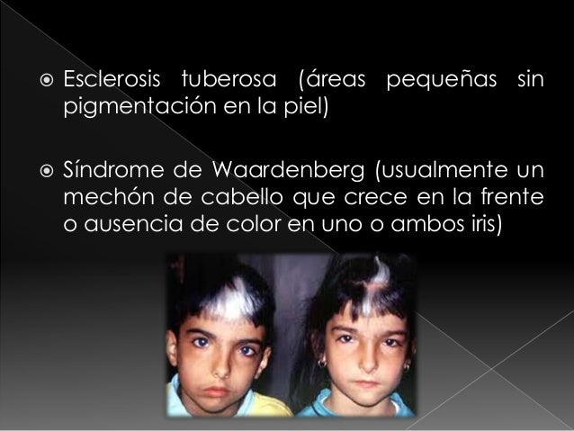 Las máscaras para la persona del perejil para el blanqueamiento