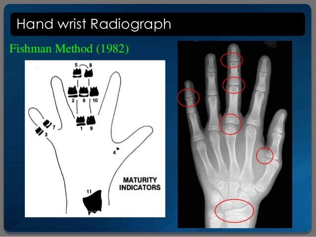 Assessment For Mature Age 89