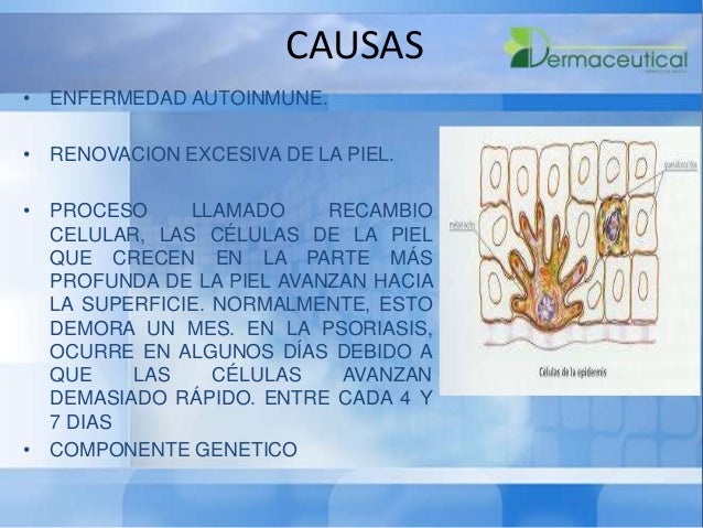 La eccema de las puntas de los dedos el foro