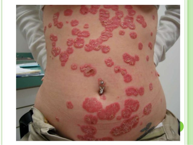 davita dialysis center sherman tx