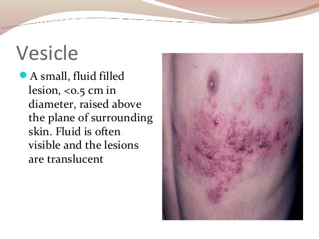 The Cunliffe (TP) Skin Lesion Diagnostic Table | Primary ...
