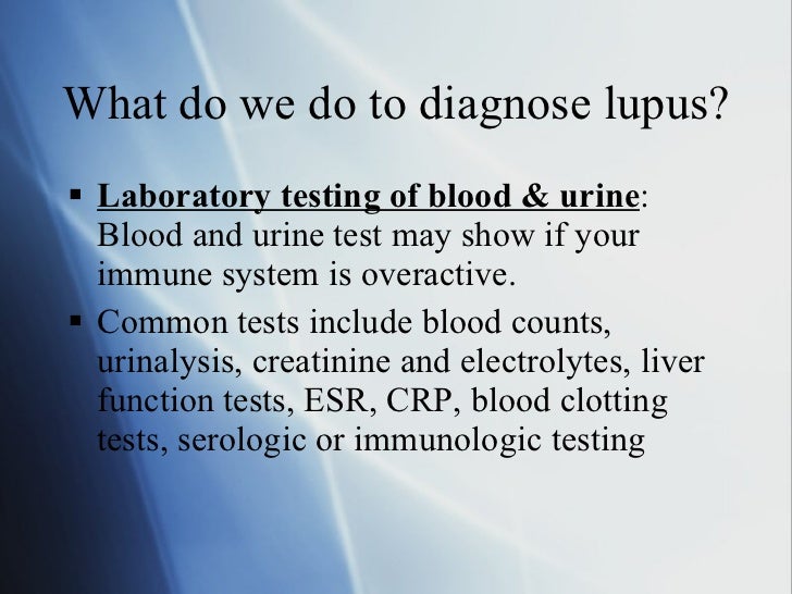 How do we diagnose lupus?