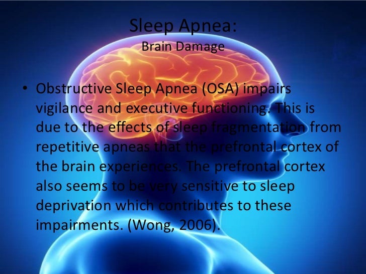 Sleep powerpoint