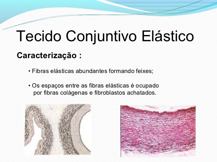 Slide tecido conjuntivo