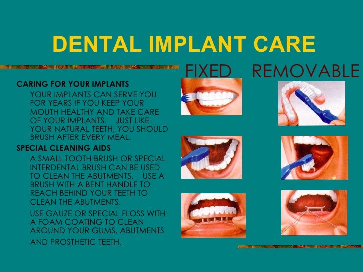 Smile Counts Dental Care